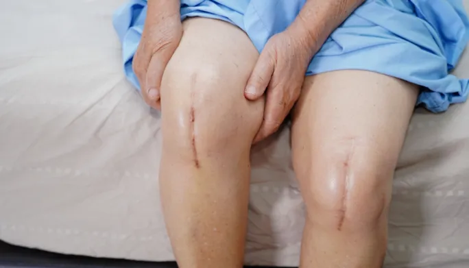 Knee Replacement Recovery Shift Therapy & Wellness in Rome, GA